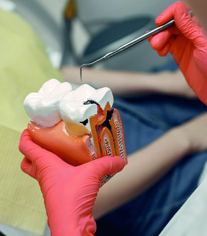 Endodonti